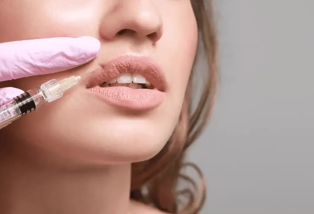 Cât durează în medie acidul hialuronic în buze